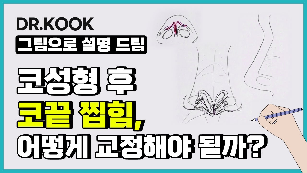 [그림설명] 코 성형 후 나타나는 코끝 찝힘, 어떻게 교정해야 될까? 썸네일
