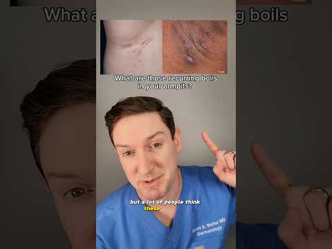 What are those recurring BOILS in your armpits? A Derm explains #derm #hidradenitissuppurativa #cyst
