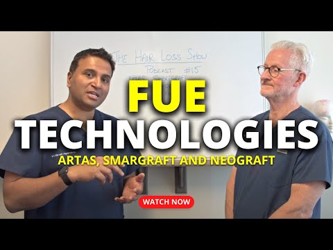 Different FUE Technologies: ARTAS, SmartGraft and NeoGraft