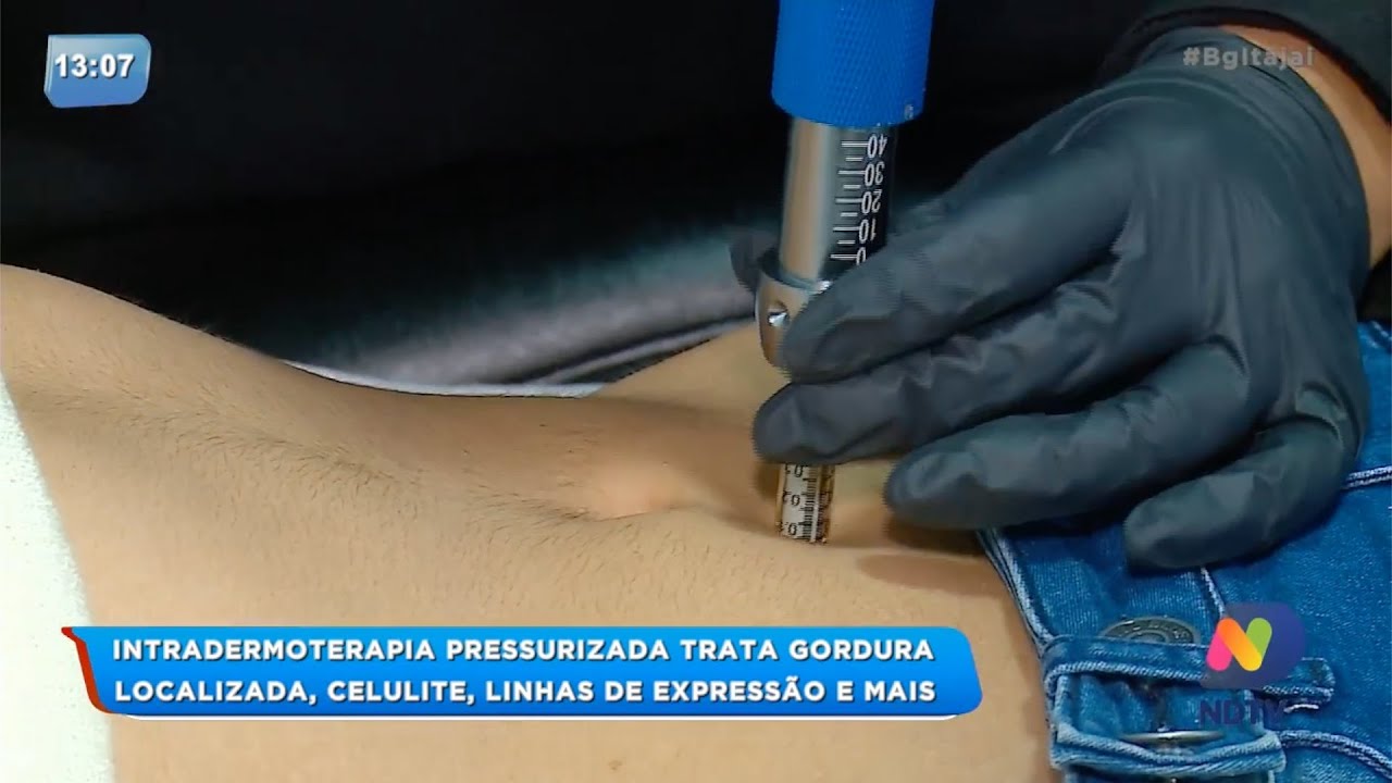 BG +: Intradermoterapia pressurizada trata gordura localizada