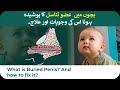What Is Burried Or Hidden Penis In Children Its Reason And Treatment Hindi And Urdu