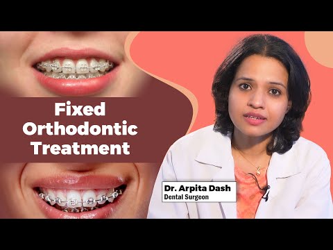 Fixed Orthodontic Treatment