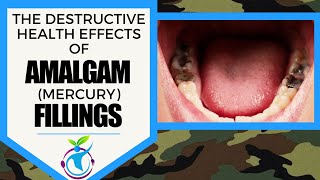 The Health Effects Of Amalgam Fillings