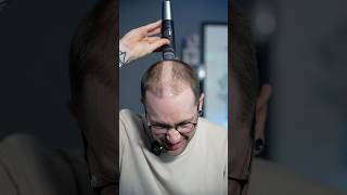I Deleted My Hair…