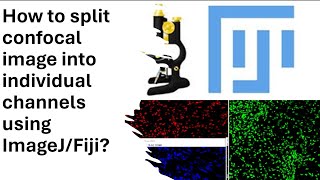 Part-4: How to split confocal image into individual channels using Ima