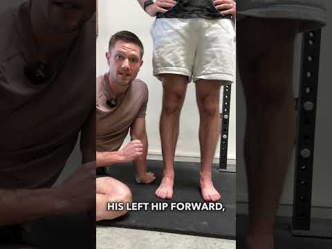 The Easiest Way To Tell How Uneven Your Hips Are! #posture #posturecorrection #backpain #lowbackpain