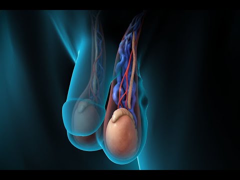 varicoza tratament exerciiu tablete din edemul piciorului în varicoza