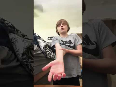 Tutorial on how to fake a broken arm #trendingshorts #trending