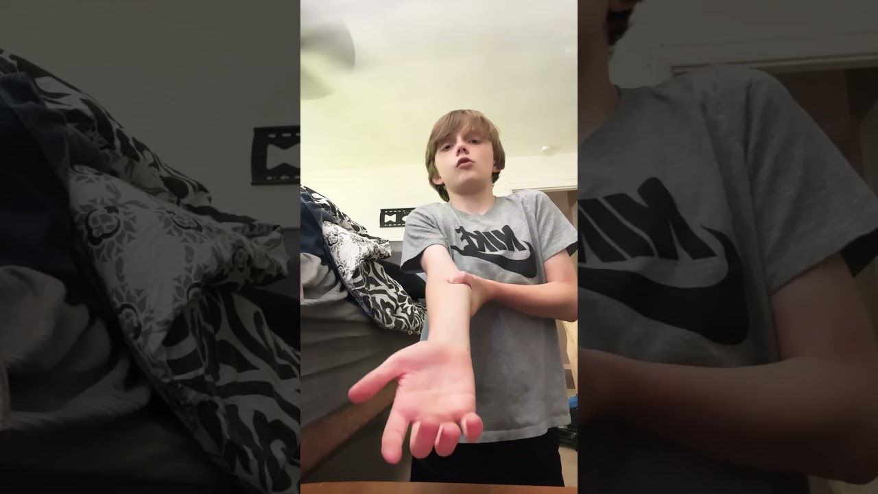 Tutorial on how to fake a broken arm #trendingshorts #trending