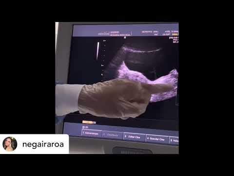video -dw-6wDPMUc