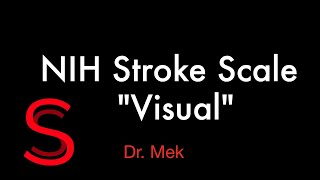 Visual:Third component of NIHSS: (E25)