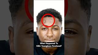 What happened to NBA YoungBoy&#39;s forehead? 🤔