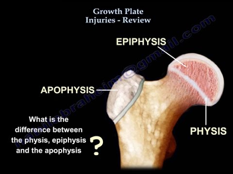 Growth Plate Injuries ,  CHILDREN FRACTURES- Everything You Need To Know - Dr. Nabil Ebraheim