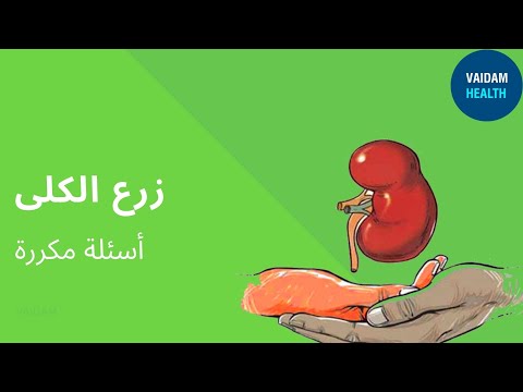 الأسئلة المتداولة حول زراعة الكلى