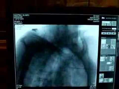 DynaCT Monitor Output