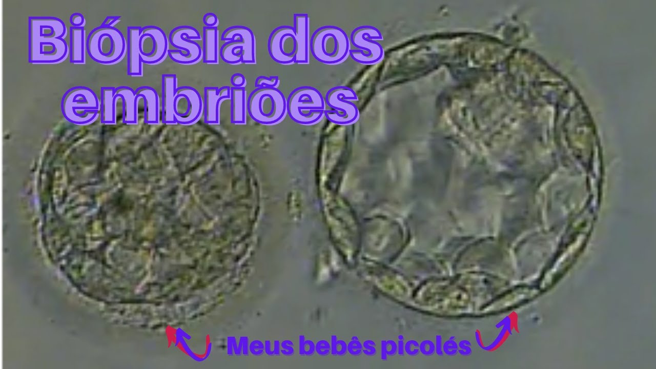 Resultado da BIÓPSIA dos embriões