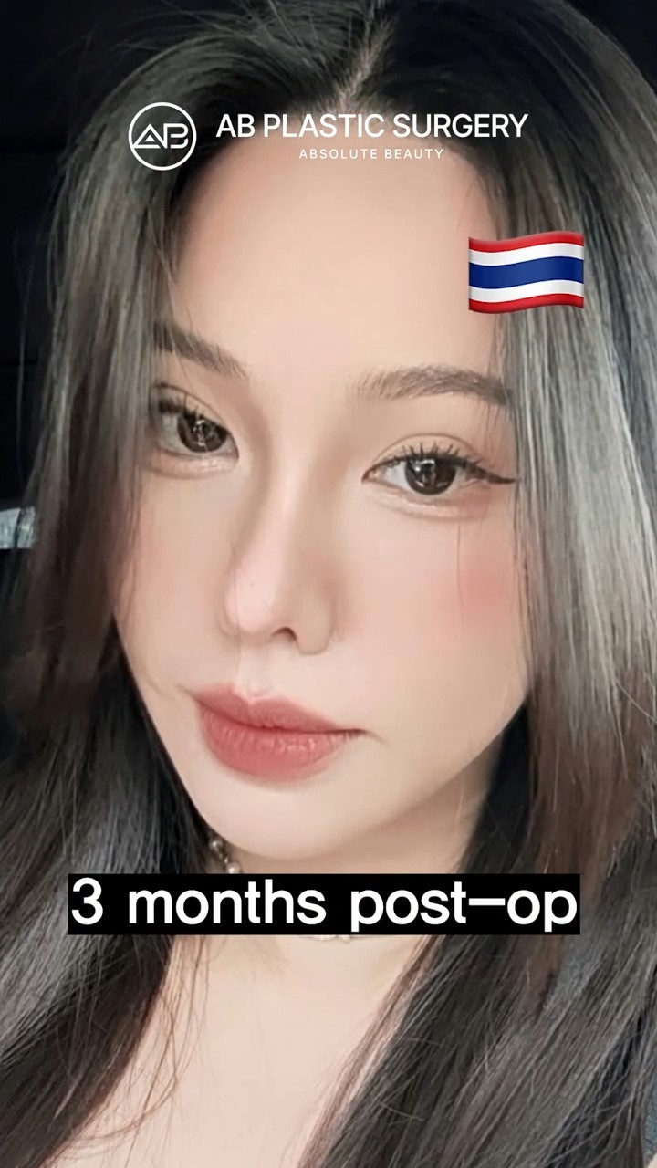 You Gotta See Her New Eyes & Nose!