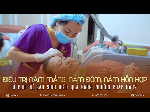 Điều trị nám mảng, nám đốm, nám hỗn hợp ở phụ nữ sau sinh hiệu quả bằng phương pháp nào?