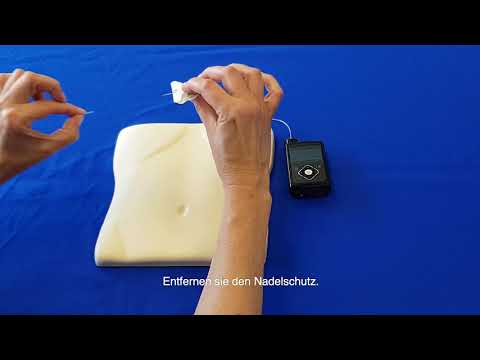 Hoher Tragekomfort und Flexibilität
MiniMed™ Silhouette™
Das MiniMed™ Silhouette™ Infusionsset bietet große Flexibilität, da der Einführwinkel zwischen 20 und 40° gewählt und somit die Einführtiefe individuell angepasst werden kann.
Durch diese Flexibilität und das dünne Profil ist Silhouette™ ideal für Kinder und Erwachsene mit wenig Unterhautfettgewebe, sehr aktive Menschen sowie während der Schwangerschaft.