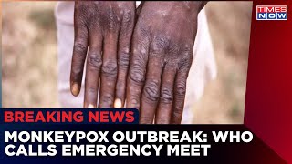 Monkeypox Outbreak: WHO Calls Emergency Meeting; India Ups Vigil At Borders | Health News