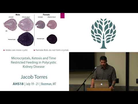 AHS18 Jacob Torres - Microcrystals, Ketosis, & Time Restricted Feeding in Polycystic Kidney Disease