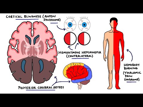 Seizures Seizure Types Generalized vs Focal Seizures Causes of Seizures Mnemonic