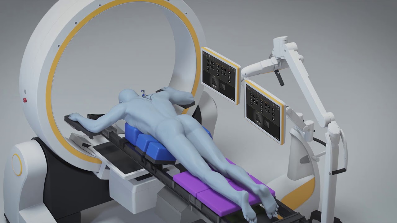 Loop-X imaging robot in an operating room setting