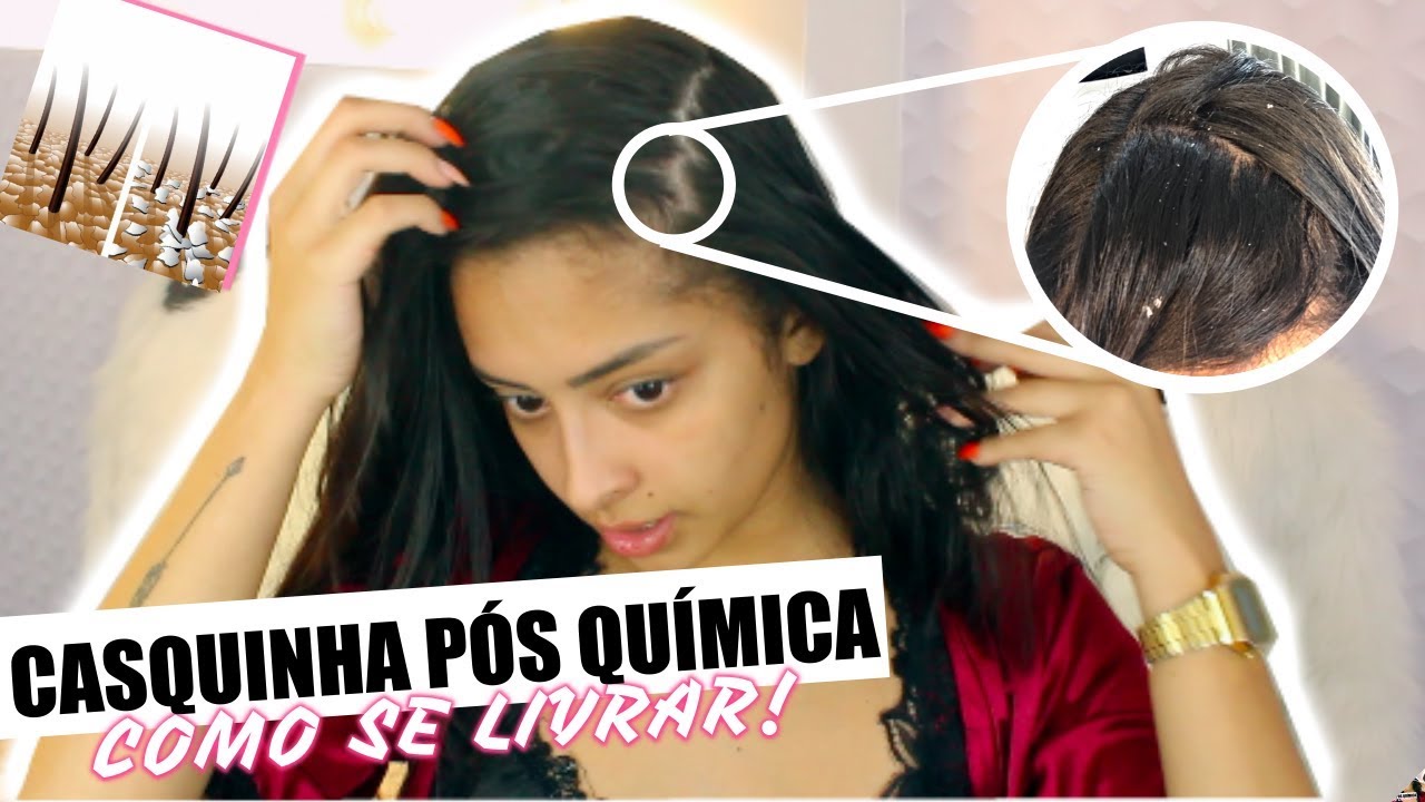 COMO SE LIVRAR DAS CASQUINHAS PÓS QUÍMICA EM 1 LAVAGEM! | Nicole Prazeres