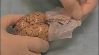 Sheep Brain Dissection - Center for Science Education