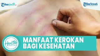 Penyebab Munculnya Warna Merah pada Tubuh saat Kerokan, Ini Manfaat Bagi Kesehatan: Jaga Kebugaran