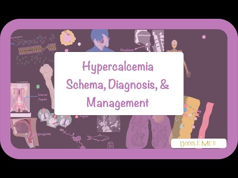 The Easiest Hypercalcemia Diagnostic and Management Algorithm I Ever Found!