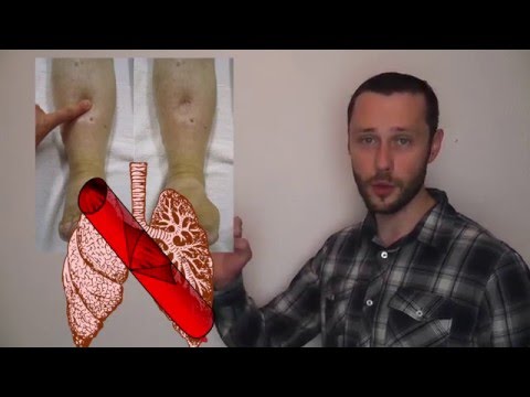 Die respiratorische Azidose