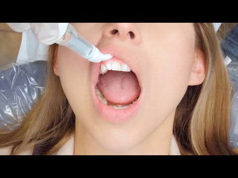 Dental Vibe - Dental Injection Device