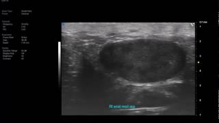 Music video thumbnail preview for Vevo MD UHF 70 - Wrist Mass by UHF