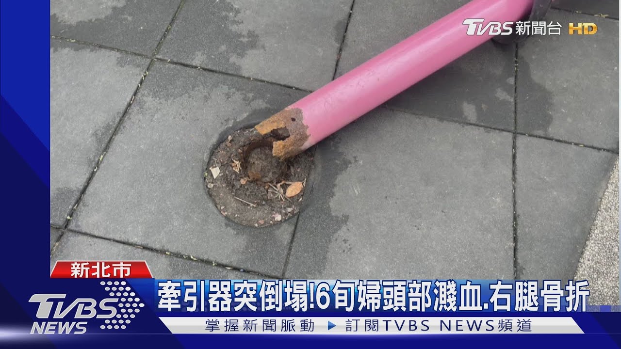 疑生鏽釀禍! 公園「牽引器」砸斷6旬婦腿