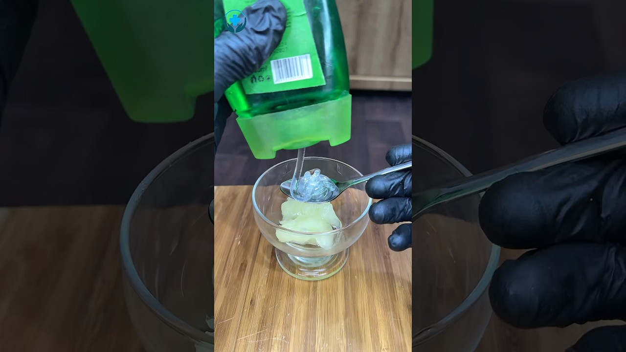 How to treat stretch marks naturally at home? #stretchmarks #stretchmarkstreatment #naturalremedy