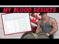 My FULL Bloodwork AFTER Using Steroids | Pro Bodybuilder