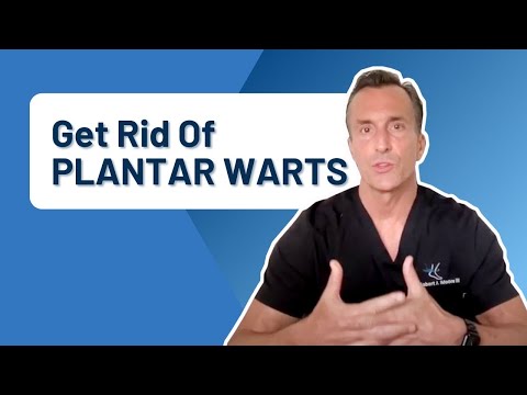 How Do You Get Rid Of Calluses Permanently