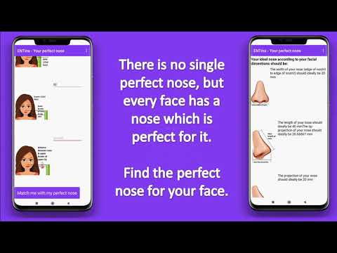 ENTina - AI powered ENT Specia Video