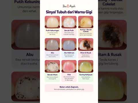 Warna Gigi Berubah? Kenali 9 Sinyal yang Tidak Boleh Diabaikan #ibudanayah
