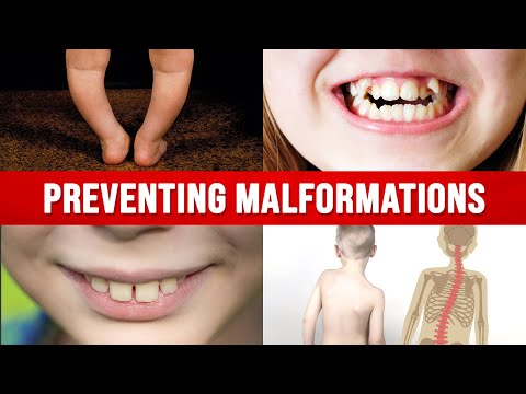 The Importance of Vitamin A in Pregnancy – Dr Berg on Source of Vitamin A Deficiency