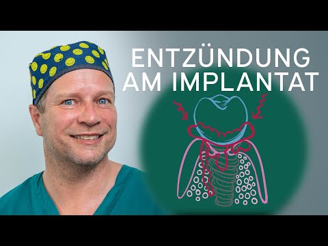 Video 5 Dr. Dröseler Praxis für Oralchirurgie Berlin