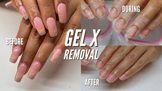 HOW TO REMOVE GEL X NAILS AT HOME!
