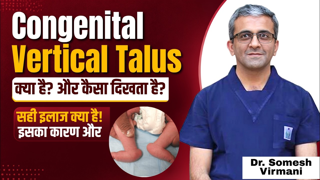 बच्चे का पैर मुड़ा या टेढ़ा है? | Congenital Vertical Talus ke कारण और इलाज समझें हिंदी में
