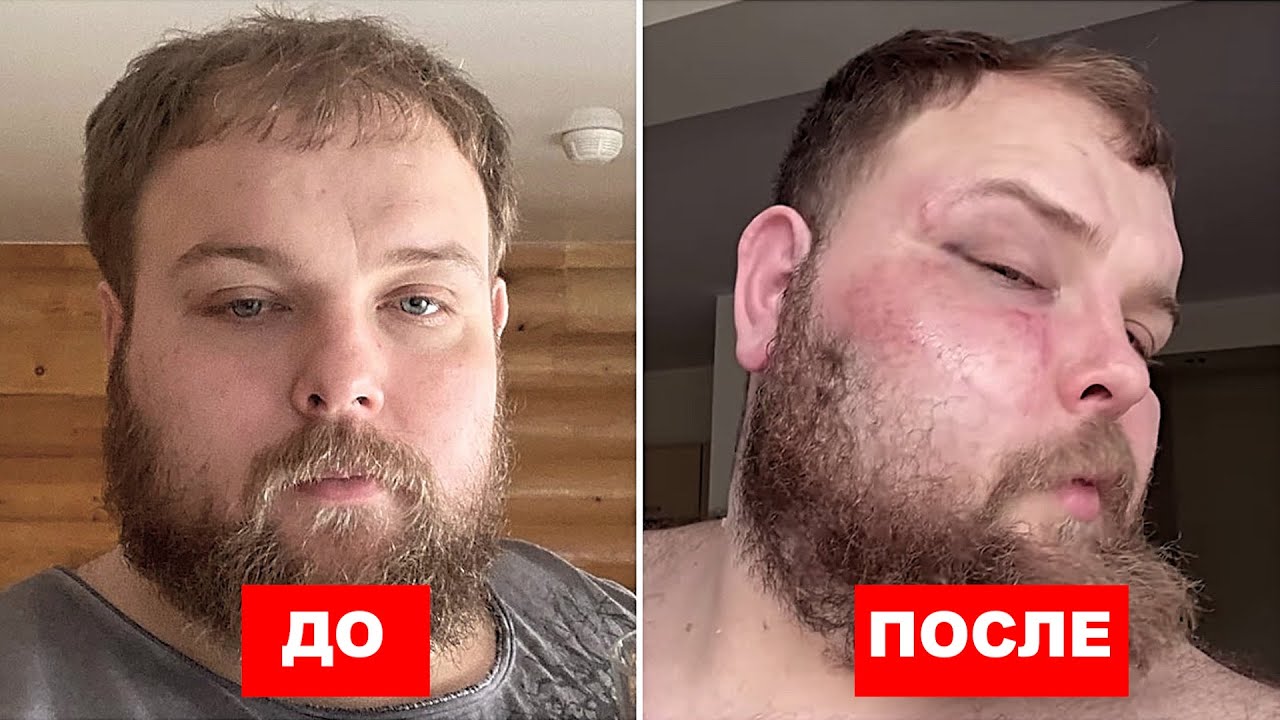 Пельмень. Слова после поражения. Ларри Уилс. Жесткая травма друга