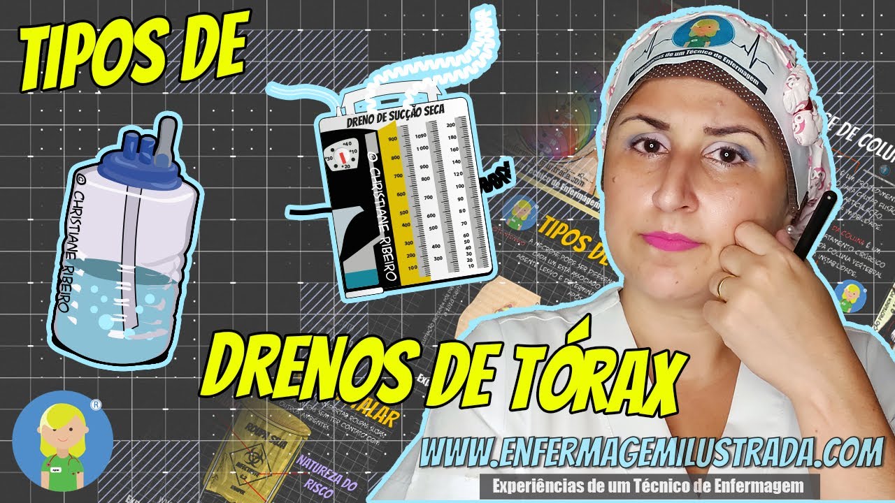 Anote aí! Os TIPOS de DRENO de tórax e os CUIDADOS de ENFERMAGEM