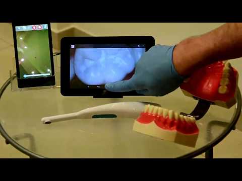 iOralCam Intraoral Camera App Video