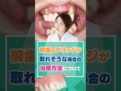 前歯のブリッジが取れそうな場合の治療方法について