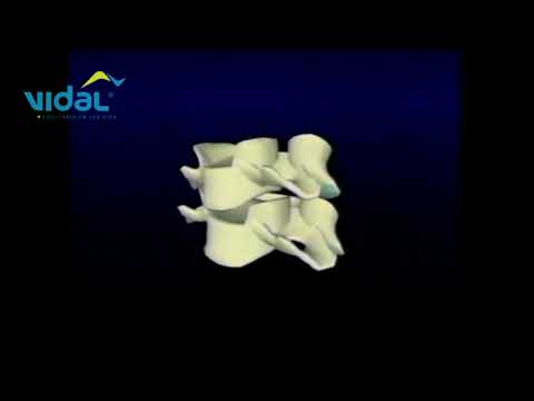 Inclinação Lateral Cervical - Vidal