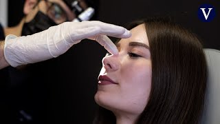 ¿Qué es una rinoplastia secundaria | Corpore Sano